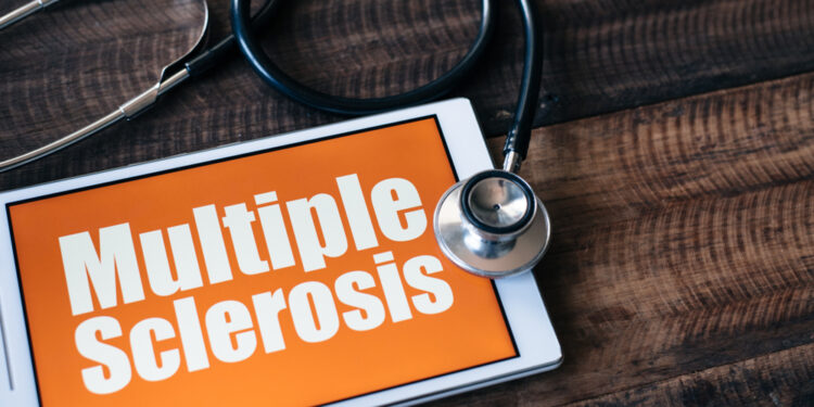 Žodžiai ir sąvokos, kuriuos verta žinoti sergant išsėtine skleroze (IS)