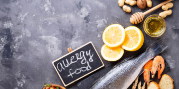 Dažniausios maisto alergijos