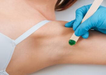 Kodėl man pažastyse atsiranda spuogų?