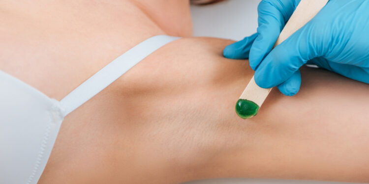 Kodėl man pažastyse atsiranda spuogų?