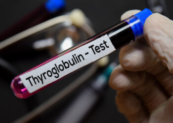 Antikūnų prieš tireoglobuliną tyrimas