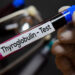 Antikūnų prieš tireoglobuliną tyrimas