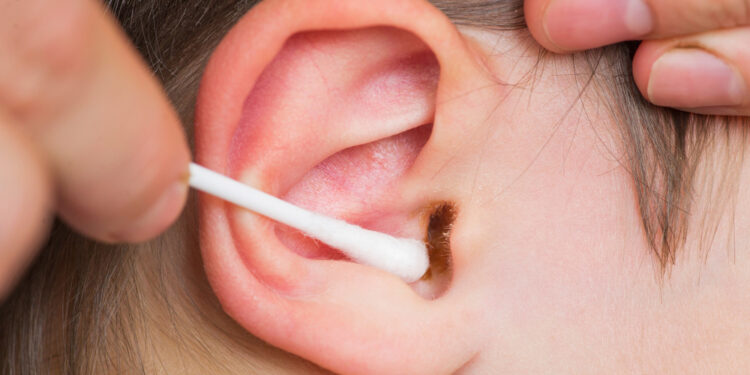 Ką reiškia jūsų ausų sieros spalva?