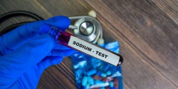 Viskas, ką reikia žinoti apie seilių narkotikų testus