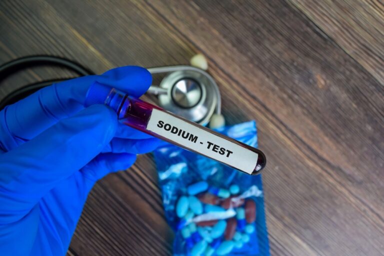 Viskas, ką reikia žinoti apie seilių narkotikų testus