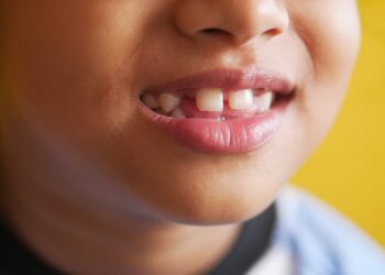 Kodėl kai kurie kūdikiai gimsta su dantimis