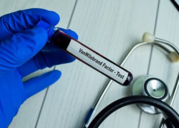 Kraujavimo trukmės testas