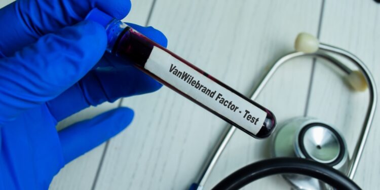 Kraujavimo trukmės testas