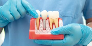 6 būdai, kaip išlaikyti sveikas dantenas