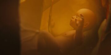 Koks yra jūsų vaisiaus vandenų indeksas ir kodėl jis svarbus?