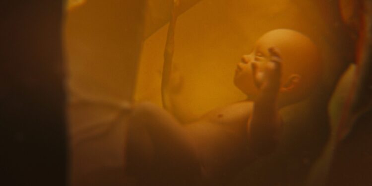 Koks yra jūsų vaisiaus vandenų indeksas ir kodėl jis svarbus?