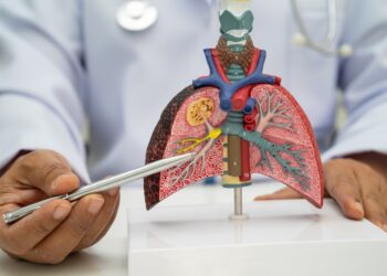 Neoperuotinas plaučių vėžys