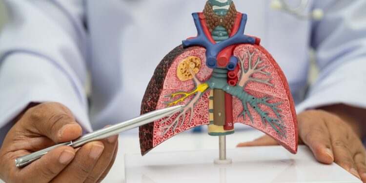 Neoperuotinas plaučių vėžys