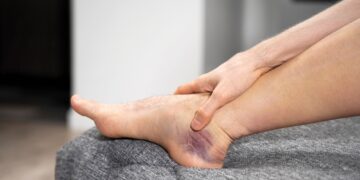 Raumens sumušimas (raumens kontūzija)