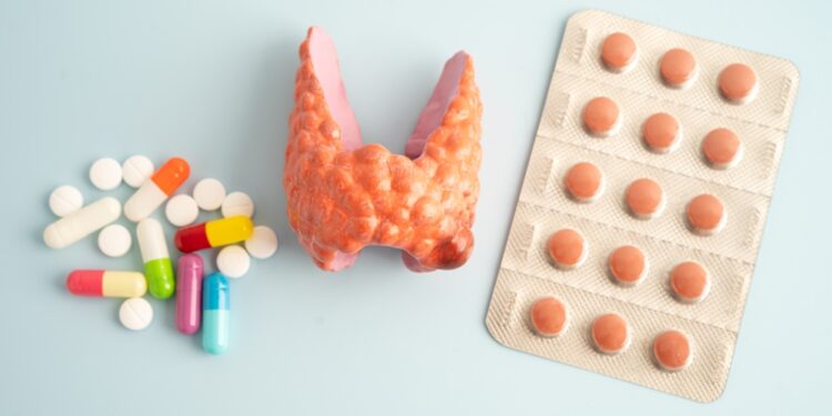 Psoriazinio artrito ir hipotirozės sąsaja