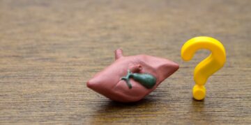 Hepatito C ir kepenų cirozės ryšys