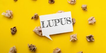 Vilkligės remisija: ar remisijos metu vilkligė praeina?