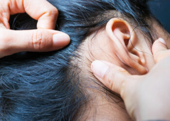 Kūno utėlių užkrėtimas