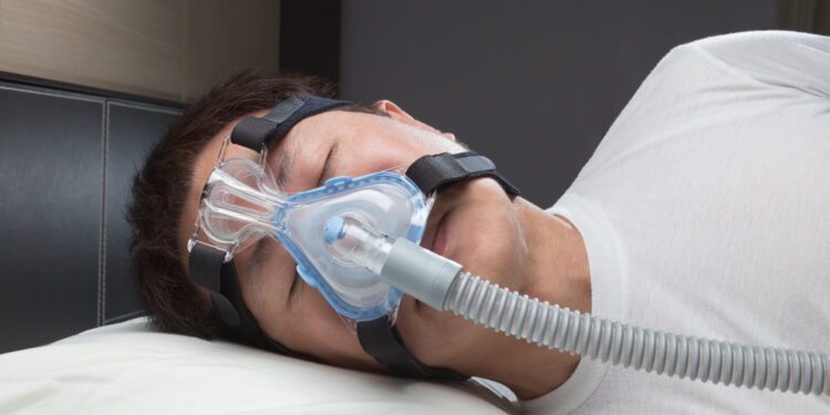 Ar CPAP aparatas miego apnėjai gali pabloginti prieširdžių virpėjimą?