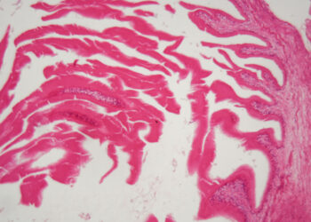 **Echinococcus** – **echinokokas**.