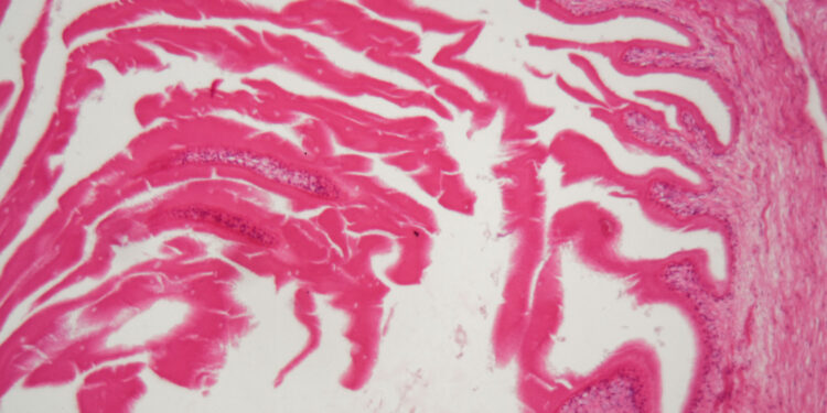 **Echinococcus** – **echinokokas**.