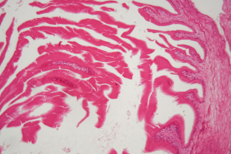 Echinococcus – echinokokas.