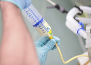 Maitinimo zondas kūdikiams