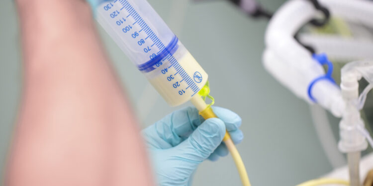 Maitinimo zondas kūdikiams