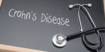 Helmintų terapija gydant Krono ligą