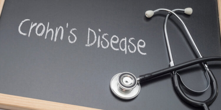 Helmintų terapija gydant Krono ligą