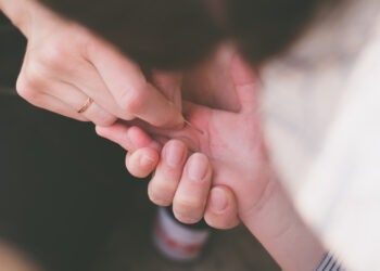 3 saugūs būdai pašalinti skeveldrą iš odos