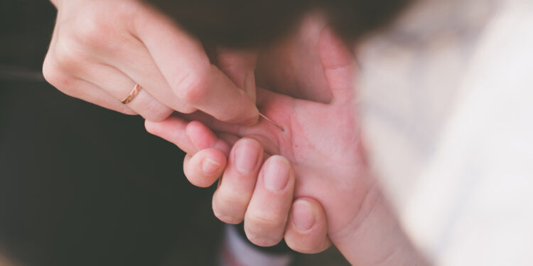 3 saugūs būdai pašalinti skeveldrą iš odos