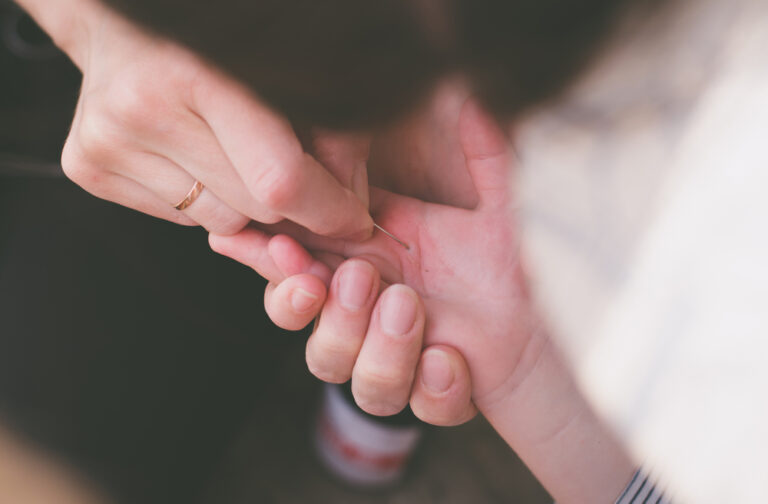 3 saugūs būdai pašalinti skeveldrą iš odos