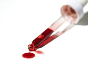 **Imunoelektroforezės tyrimas (kraujo serume)**