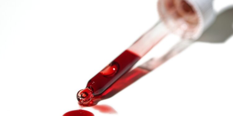 **Imunoelektroforezės tyrimas (kraujo serume)**