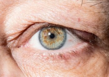 Kaip saugiai praplauti akį