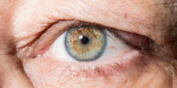 Kaip saugiai praplauti akį