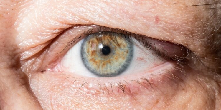 Kaip saugiai praplauti akį