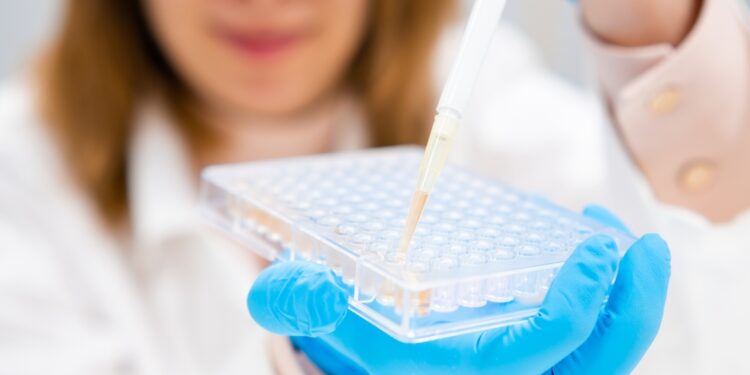 **ELISA** lietuviškai dažniausiai vartojama kaip:- **ELISA (fermentinis imunosorbentinis tyrimas)**    (taip pat sutinkama: **fermentinis imunofermentinis tyrimas**, bet rečiau)Jei tai pavadinimas sąraše ar antraštėje, natūraliai tinka: **ELISA tyrimas**.