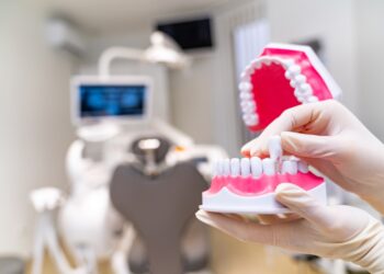 Kas yra partializmas?