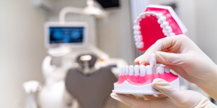 Kas yra partializmas?