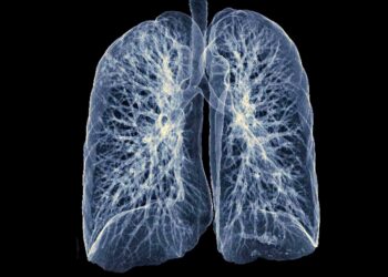 Plaučių vėžio simptomai