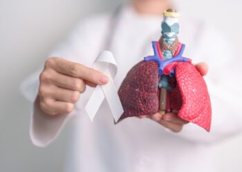 Ekspertas paaiškina: mankšta ir fizinis aktyvumas sergant plaučių vėžiu