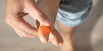 MS dilgčiojimo pobūdžio supratimas