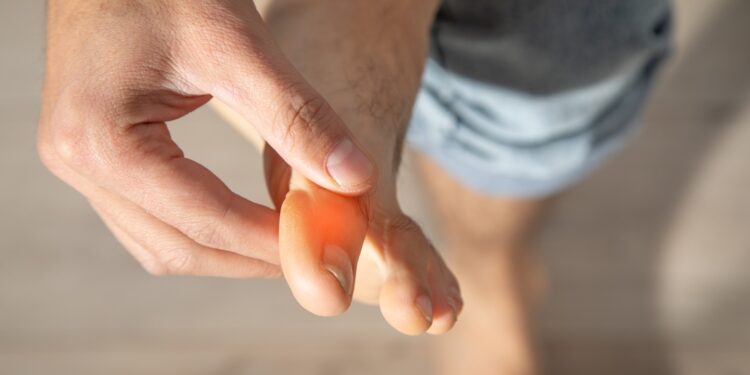 MS dilgčiojimo pobūdžio supratimas