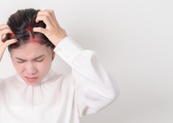 Kodėl man niežti galvos odą?