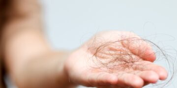 Geležies trūkumas ir plaukų slinkimas