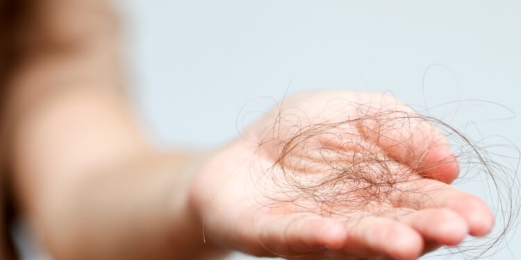 Geležies trūkumas ir plaukų slinkimas