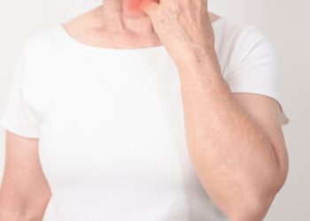 Kuo skiriasi raupsai ir žvynelinė?