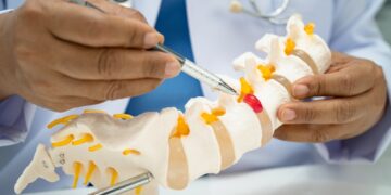 Juosmens stuburo dalies kompiuterinė tomografija (KT)